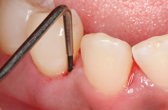 Periodontia em Santos