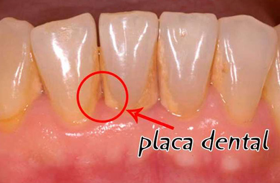 Periodontia em Santos